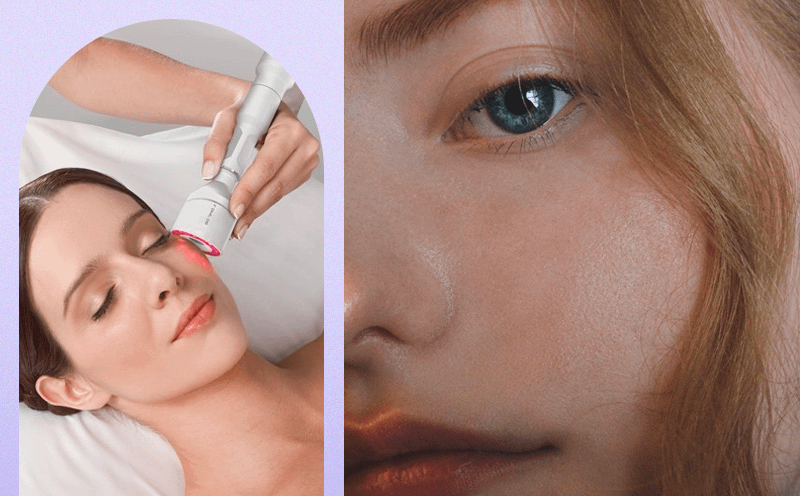 Аппарат для эпиляции, Аппарат Innovatione PRO