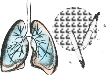 Курение вызывает рак легких
