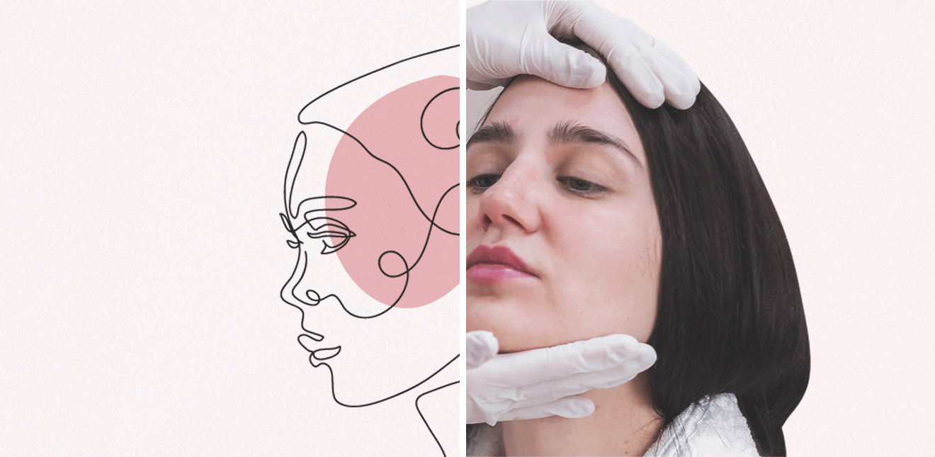 лифтинг овала лица