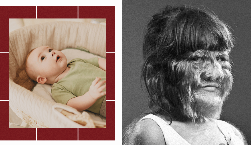 волосы на теле