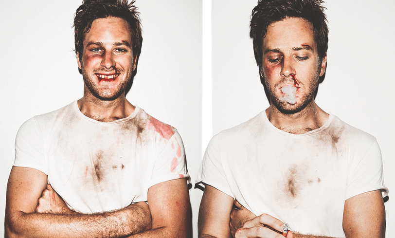 Арми Хаммер получил по зубам в новой роли